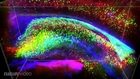 A new imaging technique to see through a brain